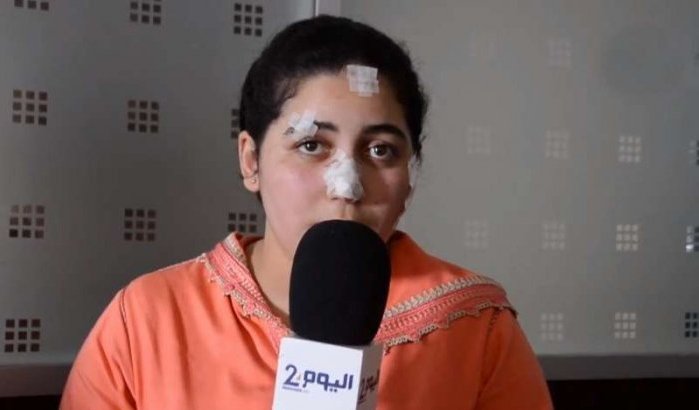 Marokkaanse die verminkt werd door echtgenoot getuigt