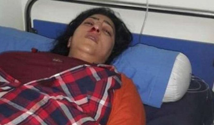 Dounia Boutazout gewond na aanval in Casablanca (foto's)