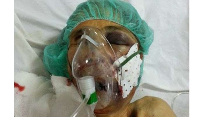 Bejaarde vrouw in coma na verkrachtingspoging in Marokko
