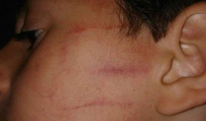 Kind op eerste schooldag door lerares mishandeld in Marokko (foto)