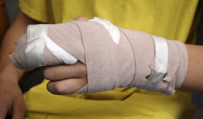 Gemeenteraadslid Fez bijt in vinger ambtenaar