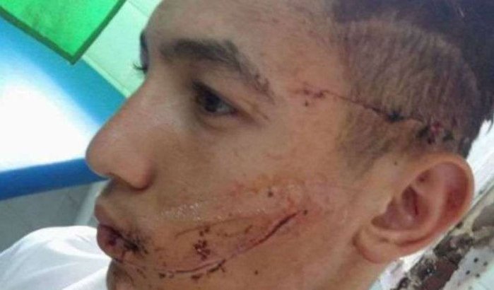 Voetballer met scheermes aangevallen in Tetouan (foto's)