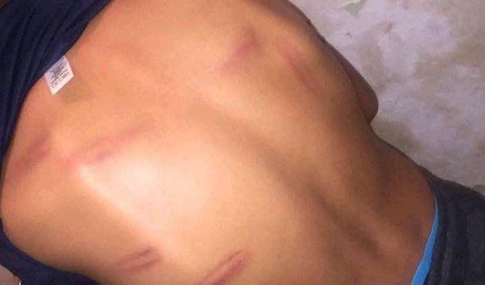Leerling zwaar mishandeld door leraar in Marokko