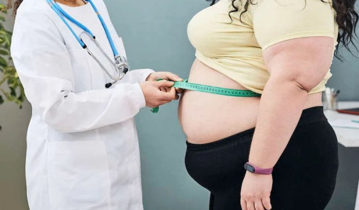 Helft Marokkaanse bevolking getroffen door obesitas in 2035
