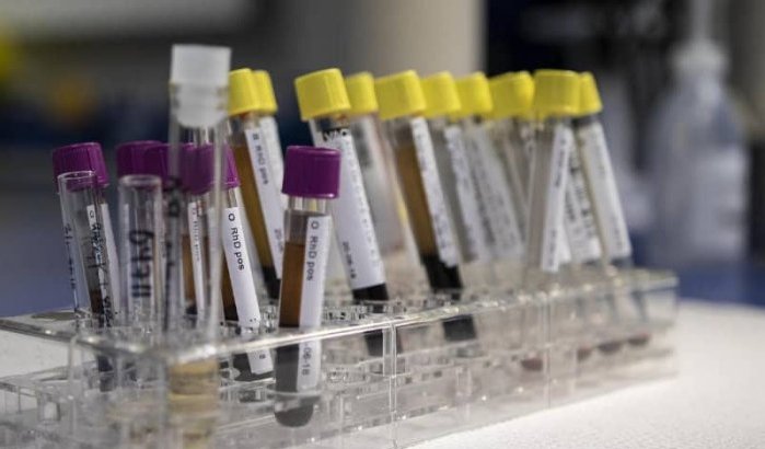 Marokko: positieve resultaten na klinische proeven met coronavaccin