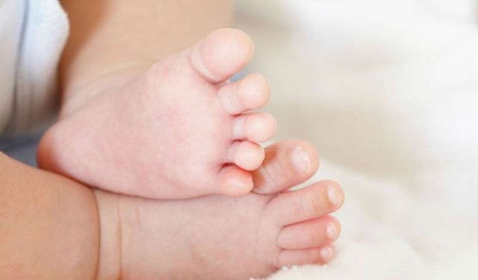 Baby met twee hoofdjes geboren in Rabat