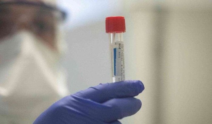 Marokko: Marokkaanse uit Italië weigert coronavirus-test