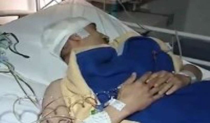Leraar in hoofd gestoken door student in Fez