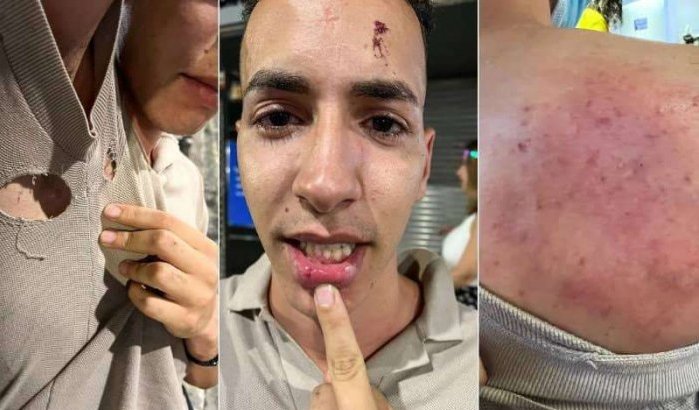 Marokkaan slachtoffer racistische aanval in Spanje