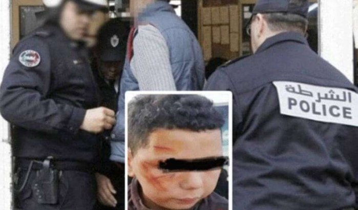 Nachtwaker opgepakt voor verminken kind in Tanger