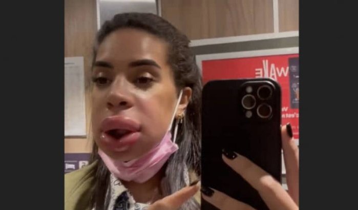 Cosmetische ingreep Marwa Merazka eindigt bijna in ramp