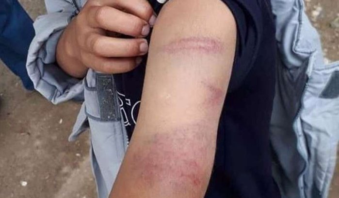 Lerares mishandelt leerling die 'M' niet kan schrijven in Chefchaouen