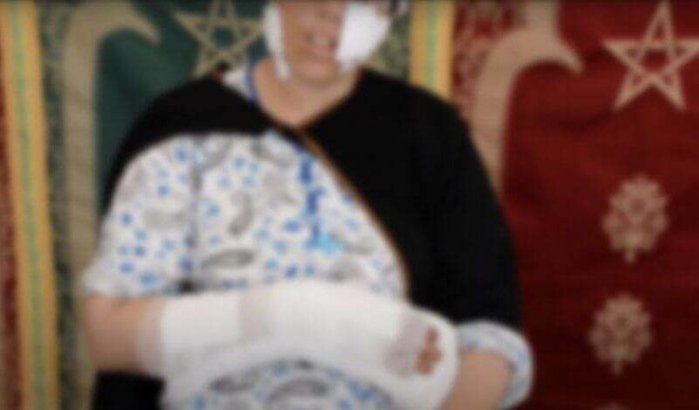 Marokko: jaloerse echtgenoot valt vrouw met machete aan (video)