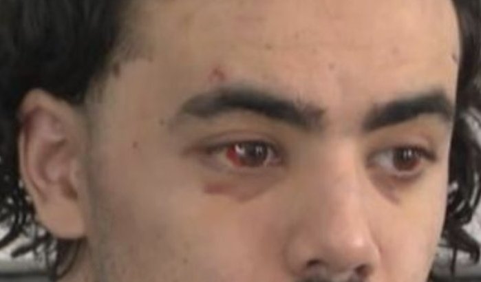 Oussama slaat politieman in Anderlecht, zag hem aan voor inbreker 