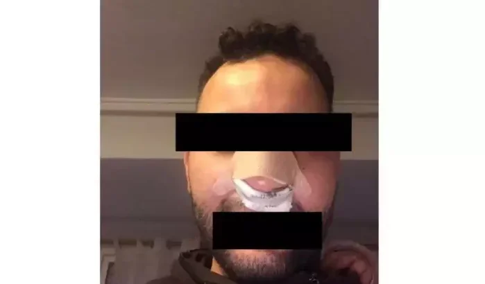 Racistische aanval in Spanje: Marokkaan eist gerechtigheid