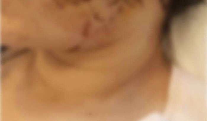 Mohamed Daly opgepakt voor verminken ex-vrouw in Molenbeek