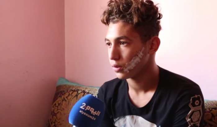 Marokkaanse voetballer vertelt over aanval met scheermes (video)