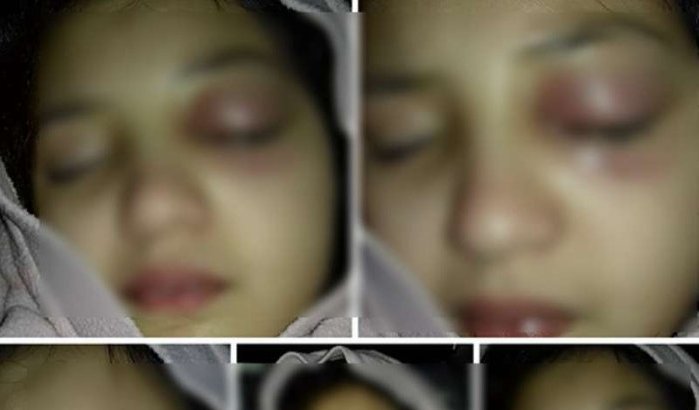 Meisje overleden na door lerares te zijn mishandeld in Marokko (video)
