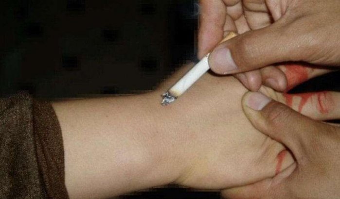 Peuter in Agadir mishandeld en met sigaretten verbrand door vader