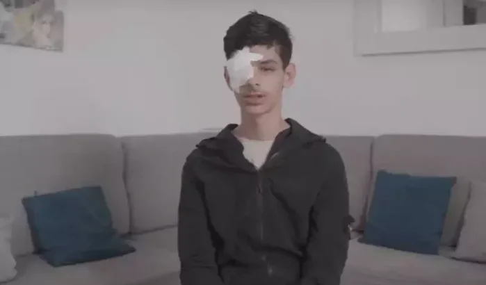 Oog verloren door politie, Jalil (15) vertelt