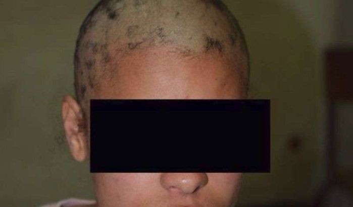 Zaak kaalgeschoren Chaimaa op 30 mei voor de rechter