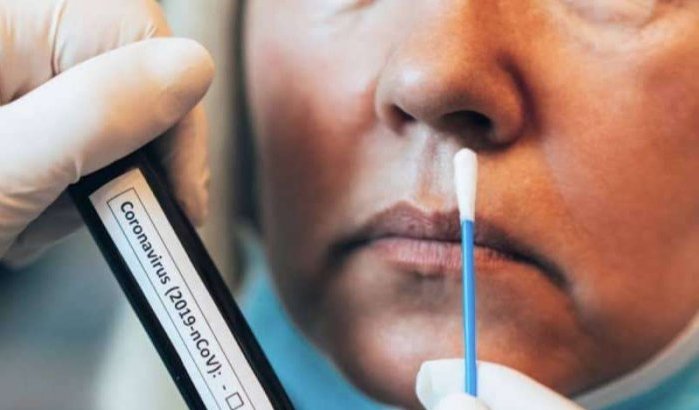 Marokko: verdeeldheid over prijsverlaging coronatest