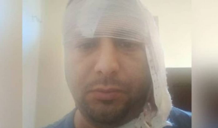 Raadslid aangevallen met mes in Larache