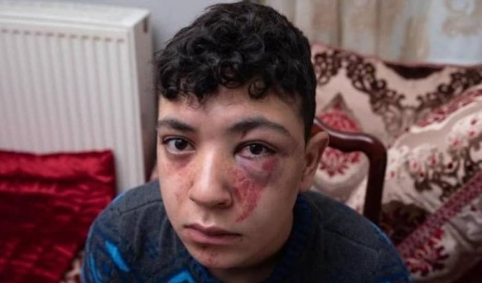 België: aanklacht politiegeweld op Mounaim afgewezen