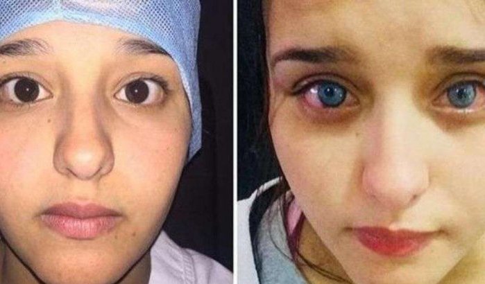 Primeur in Marokko: vrouw verandert definitief van oogkleur