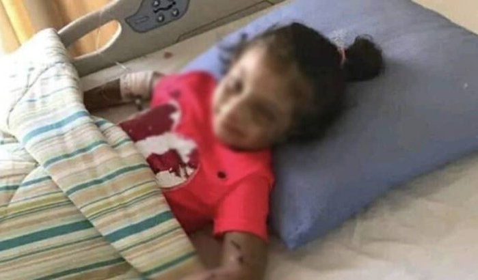 Moeder gearresteerd voor martelen dochter (6) in Salé