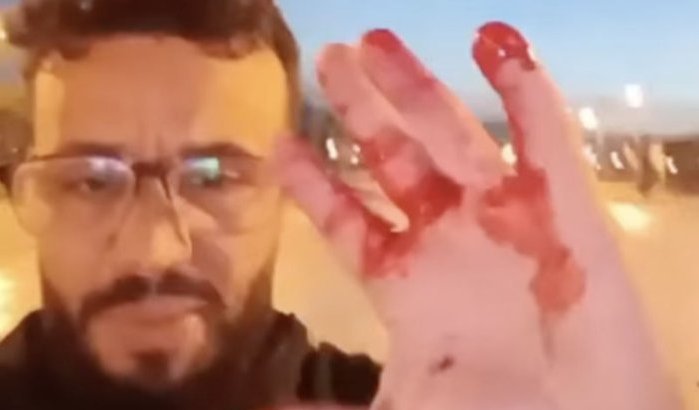 Bilal slachtoffer roofoverval in Tanger, politie rijdt door (video)