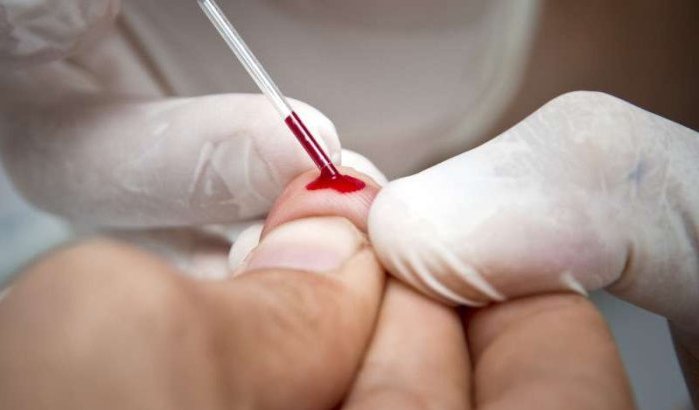 Aids-testen in gevangenissen Marokko
