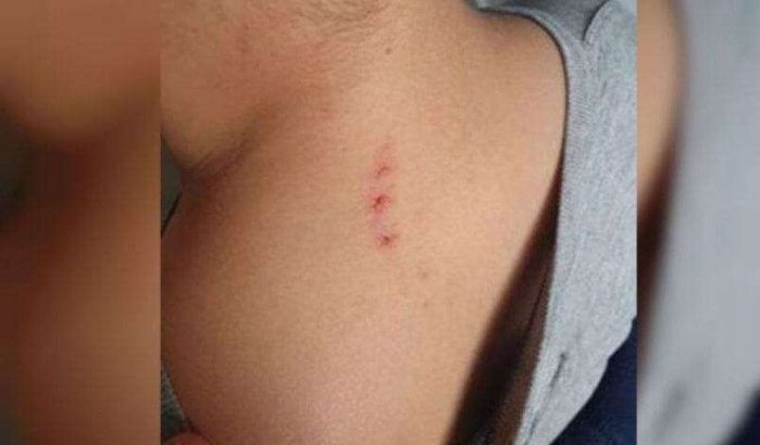 Bilal (8) door lerares mishandeld in Frankrijk