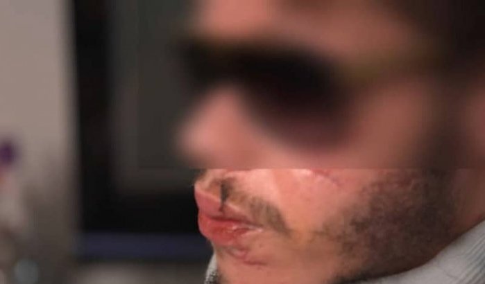 Marokkaan mishandeld door politieagent in Parijs