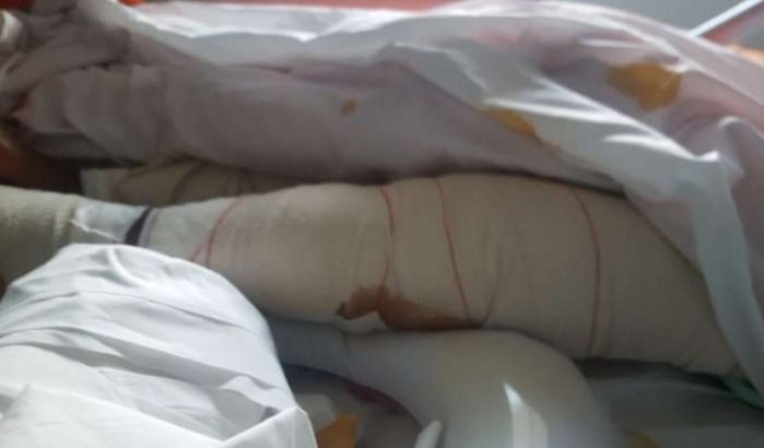 Marokko: mishandelde meid Latifa mag ziekenhuis verlaten