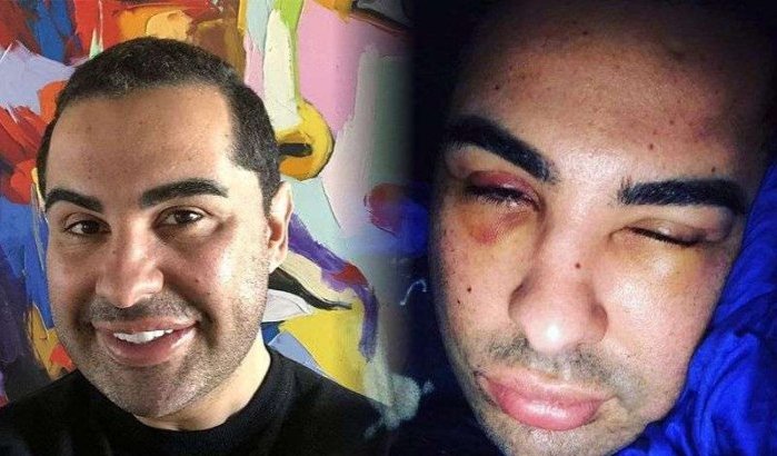 Bekende seksuoloog Doc Samad verlaat Marokko na mishandeling