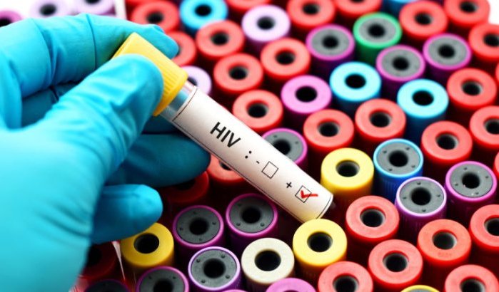 Kind besmet met hiv tijdens operatie in Marokko