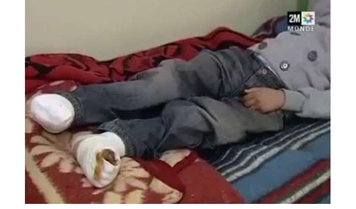Marokkaans jongetje wekenlang gemarteld door stiefvader