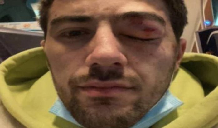 Marokkaanse acteur zwaar mishandeld in Parijs
