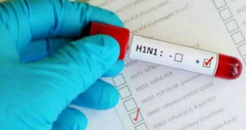 H1N1-griepvirus Marokko