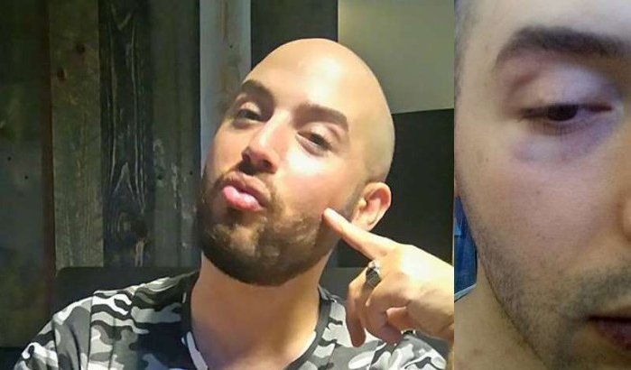 Mishandelde homo Adouma vertelt over aanval