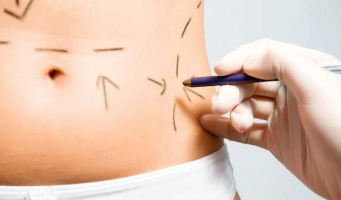 Dodelijke liposuctie in Casablanca