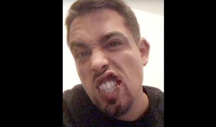 Bekende Marokkaanse rapper zwaar mishandeld in Frankrijk