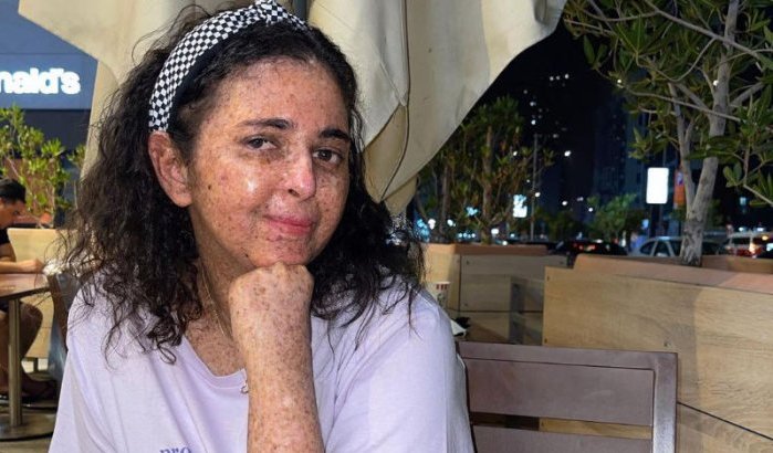 Het levensverhaal van Fatima Zahra El Ghazaoui: pionier in de strijd tegen zeldzame ziekten