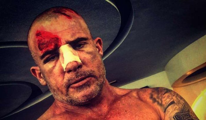 Prison Break acteur Dominic Purcell gewond tijdens opnames in Marokko