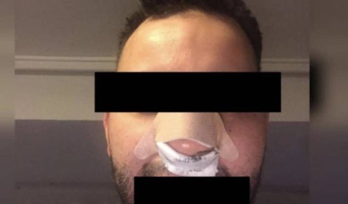 Marokkaan in Spanje slachtoffer racistisch geweld