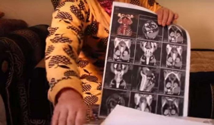 Marokkaanse al 9 jaar zwanger? (video)