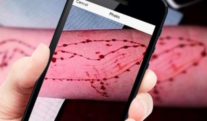 Ibrahim (13) eerst slachtoffer blue whale challenge in Marokko