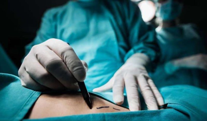 Plastische chirurgie populair onder Marokkaanse politici