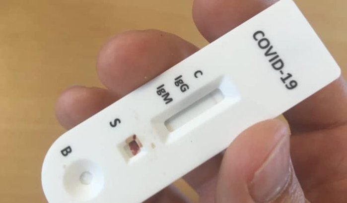 Marokko introduceert snelle antigeen coronatests